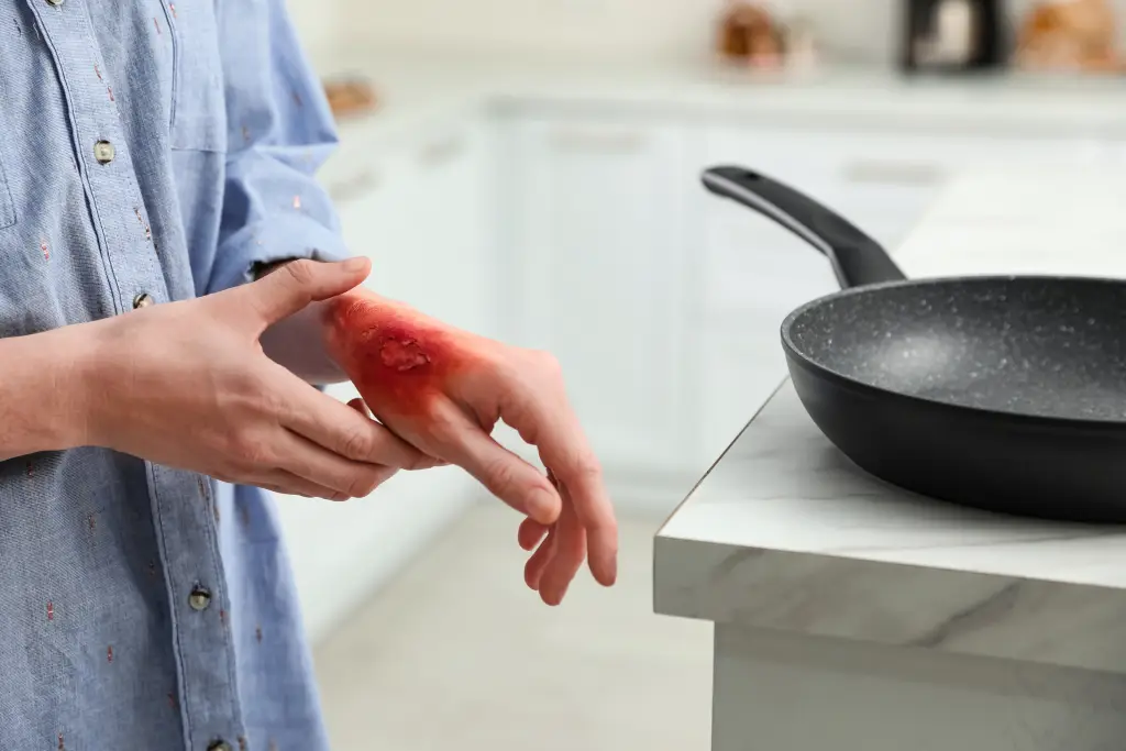 kitchen health and safety