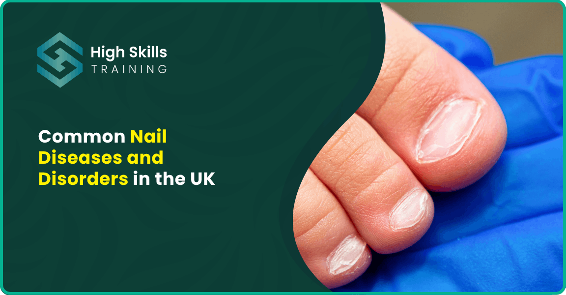 Common Nail Diseases and Disorders in the UK